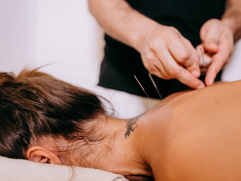 acupuncture adelaide