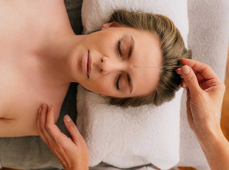 acupuncture adelaide